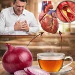Šećer u krvi se trenutno snižava uz ovaj recept s ljubičastim lukom!” Pravo kulinarsko blago koje malo ko poznaje
