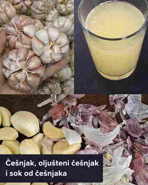 Zašto ne biste trebali bacati ljuske bijelog luka: iznenađujuće koristi i upotrebe koje većina ljudi ne zna