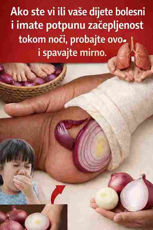 Ako ste vi ili vaše dijete bolesni i imate potpunu začepljenost nosa tokom noći, probajte ovo i spavajte mirno.