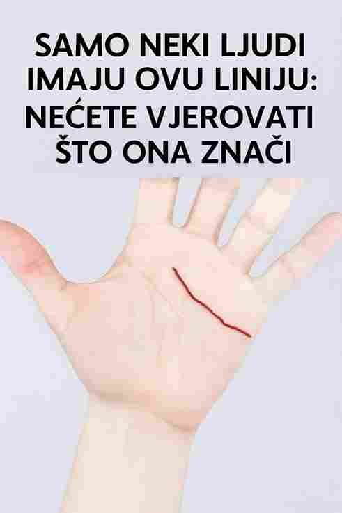 SAMO NEKI LJUDI IMAJU OVU LINIJU: Nećete vjerovati šta ona znači 👀✨