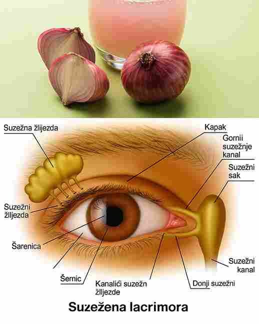 Poboljšajte vid prirodno uz pomoć luka za samo 5 dana kod kuće