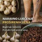 Moja majka nije mogla hodati zbog proširenih vena i bolova u nogama