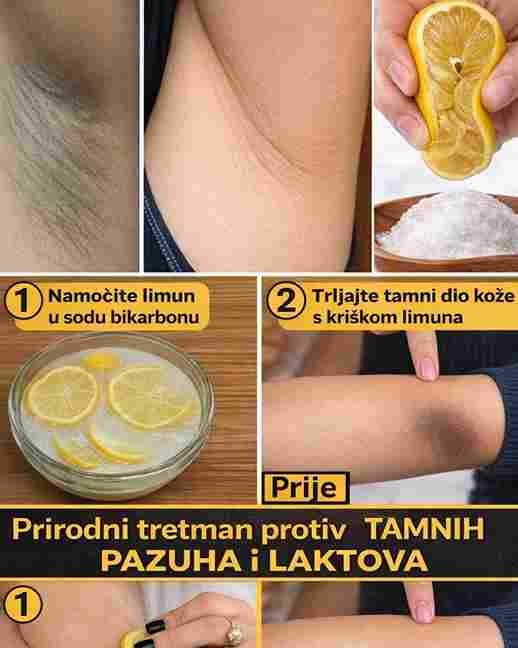 Svaka žena treba znati moć limuna