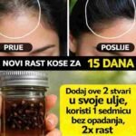 Riža i ulje klinčića: Nema opadanja kose i dvostruki rast za 7 dana