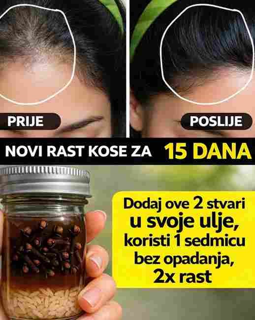 Riža i ulje klinčića: Nema opadanja kose i dvostruki rast za 7 dana