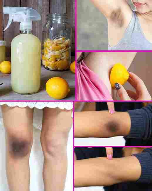 Svaka žena treba znati da limun ima ovu moć… 🍋✨