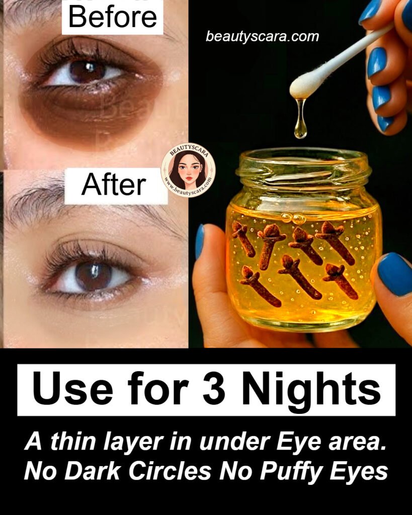 Koristite 3 noći: Prednosti karanfilića i meda 🌿🍯