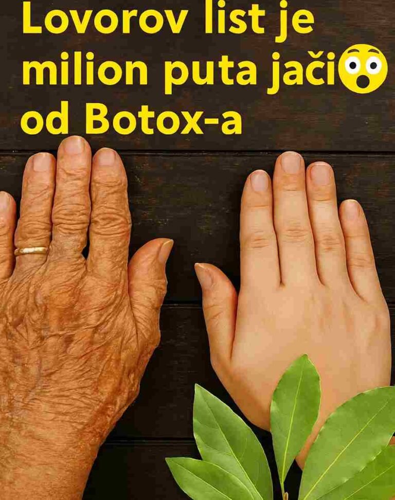 Kad pomislim na žene u svojoj porodici, sjetim se njihovih tihih rituala — jednostavnih načina na koje su se brinule o sebi mnogo prije modernih krema i skupih tretmana. Među staklenkama začinskog bilja u kuhinji moje nane uvijek je stajalo jedno koje je posebno voljela: lovorov list. Uvijek bi se nježno osmjehnula dok bi nekoliko listova ubacila u toplu vodu, puštajući da se para podigne oko njenog lica. “Priroda nam daje sve što nam treba,” šaputala bi. I iako nikada nije govorila o borama ili linijama, njena je koža uvijek imala onaj mekani, smireni sjaj koji dolazi iz godina nježne i pažljive brige o sebi. Danas ljudi pričaju uzbuđeno o skupim beauty trendovima, ali se mnogi i dalje vraćaju ovom skromnom listu — ne kao čudesnom lijeku, već kao umirujućoj tradiciji koja pruža relaksaciju, mekoću kože i osjećaj prirodnog blagostanja. Tradicionalne Prednosti (Narodna Mudrost) Iako lovorov list nije zamjena za kozmetičke tretmane, generacijama se koristio u domaćoj njezi. U narodnim praksama vjeruje se da: pomaže u opuštanju svojim toplim, umirujućim mirisom osvježava kožu kroz blagu parnu njegu sadrži prirodne antioksidanse povezane s opštim zdravljem kože tonira i čisti lice u tradicionalnim beauty ritualima podržava cirkulaciju kroz tople obloge Ove upotrebe potiču iz tradicije, a ne iz medicinskih tvrdnji — jednostavni načini na koje su se porodice brinule o sebi koristeći darove prirode. Domaći Parni Tretman s Lovorovim Listom Sastojci: 4–6 suhih lovorovih listova 2 šolje vruće vode Posuda i čista peškira Uputstvo: Prokuhajte vodu i pažljivo je prelijte u posudu otpornu na toplotu. Dodajte lovorove listove i ostavite da odstoje 1–2 minute. Nagnite lice iznad posude na udobnoj udaljenosti i prebacite peškir preko glave da zadržite paru. Dišite duboko i pustite da topla, aromatična para nježno dodiruje vašu kožu 5–7 minuta. Nježno osušite lice i nanesite svoju omiljenu prirodnu hidratantnu kremu. Mnogi vole ovaj ritual zbog njegovog umirujućeg mirisa i svježeg osjećaja koji ostavlja na koži. Dodatni Savjeti Toner od lovora: Prokuhajte 3–4 lista u jednoj šolji vode, ostavite da se ohladi i koristite kao blagi losion za lice. Kupka za opuštanje: Ubacite šaku lovorovih listova u toplu kupku za osjećaj kućnog spa tretmana. Aromatično ulje: Potopite lovorove listove u zagrijano ulje da dobijete mirisno ulje za masažu koje se tradicionalno koristi za opuštanje. Osvježivač doma: Stavite nekoliko listova u fioke ili ormare za prirodan, prijatan miris. Topla Završna Poruka Lovorov list nas podsjeća da ljepota, udobnost i briga o sebi ne moraju dolaziti iz skupih bočica — ponekad dolaze iz najjednostavnijih stvari koje smo imali u kuhinji generacijama. Ako vas ovaj starinski ritual privlači, probajte ga uvrstiti u svoju sedmičnu rutinu i pogledajte kako se osjećate. I zapamtite: ovo je tradicionalna narodna praksa, a ne medicinski ili kozmetički savjet. Ako imate probleme s kožom ili posebna stanja, posavjetujte se s profesionalcem prije isprobavanja novih rituala.