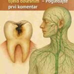 Trule zube nisu samo problem zuba: Kako utiču na cijelo tijelo 🦷⚠️