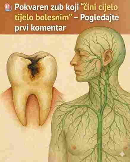 Trule zube nisu samo problem zuba: Kako utiču na cijelo tijelo 🦷⚠️