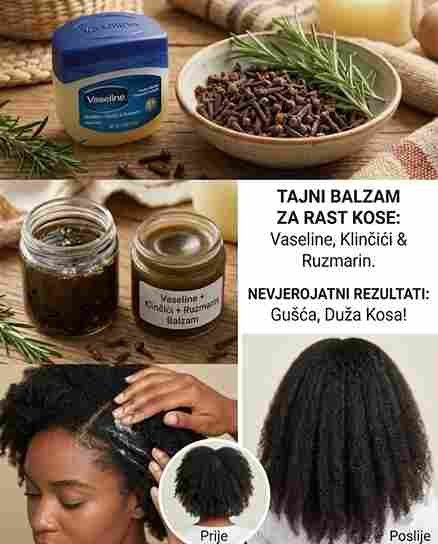 Pomiješajte VASELIN, KLINČIĆ i RUZMARIN – I Raste Vam Kosa 10x Brže!