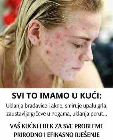 SVI GA IMAMO U KUĆI: Uklanja Bradavice, Akne i Perut, a Smiruje Grlo i Grčeve!