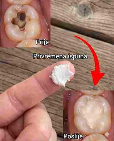 Držite se ovih savjeta i izbjegnite posjete stomatologu: Kako prirodno popraviti karijes 🦷🌿