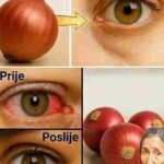 Poboljšajte vid prirodno: 5-dnevna rutina sa lukom