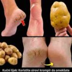 Samo jedan krompir može zauvijek riješiti problem ispucalih peta 🥔🦶