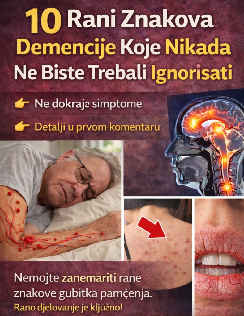 10 Rani Znakova Demencije Koje Nikada Ne Biste Trebali Ignorisati