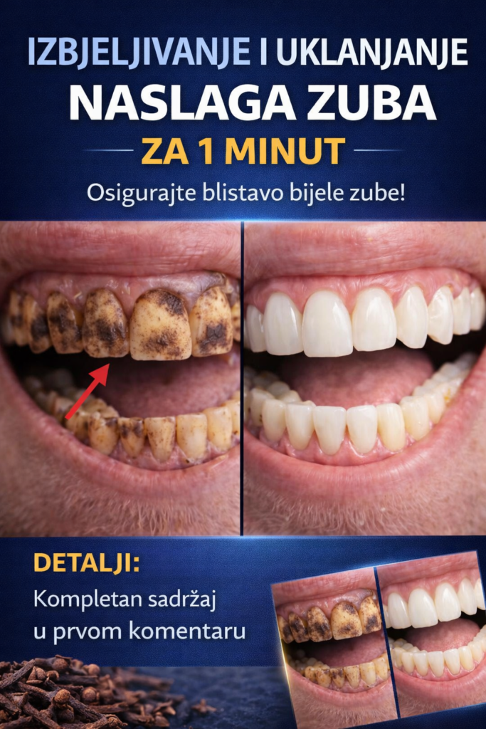 Izbjeljivanje i Uklanjanje Naslaga Zuba – Šta Zaista Djeluje?